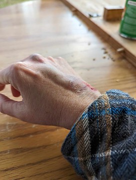 15 minutes after the injury.