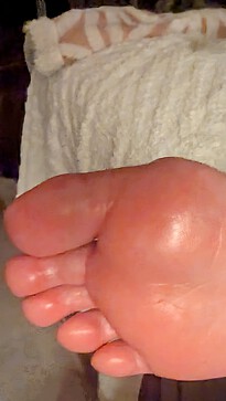 Swollen on fire feeling like bees are stinging me. But also in my knees hands , ears and face & feet . 